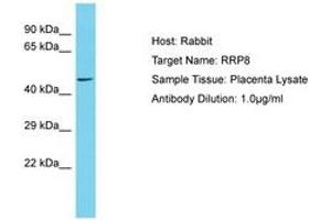 Image no. 1 for anti-Ribosomal RNA Processing 8 (RRP8) (AA 100-149) antibody (ABIN6750590) (RRP8 anticorps  (AA 100-149))