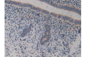 Detection of GAB3 in Mouse Uterus Tissue using Polyclonal Antibody to GRB2 Associated Binding Protein 3 (GAB3)