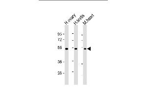 All lanes : Anti-VEGF3 Antibody at 1:2000 dilution Lane 1: human ovary lysate Lane 2: human testis lysate Lane 3: mouse heart lysate Lysates/proteins at 20 μg per lane. (VEGFC anticorps  (C-Term, N-Term))