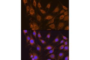 Immunofluorescence analysis of C6 cells using SEL1L antibody (ABIN6132642, ABIN6147499, ABIN6147500 and ABIN6215644) at dilution of 1:100. (SEL1L anticorps  (AA 22-190))