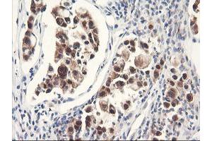 Image no. 5 for anti-F-Box Protein 21 (FBXO21) antibody (ABIN1498231) (FBXO21 anticorps)