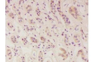 Formalin-fixed and paraffin embedded human kidney labeled with Anti-IFNAR1 Polyclonal Antibody, Unconjugated  at 1:300 followed by conjugation to the secondary antibody and DAB staining. (IFNAR1 anticorps  (AA 351-450))