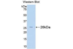 Detection of Recombinant Bid, Rat using Polyclonal Antibody to BH3 Interacting Domain Death Agonist (Bid) (BID anticorps  (AA 1-196))