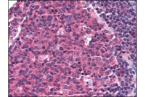 Immunohistochemistry (IHC) image for anti-Chemokine (C-C Motif) Receptor 5 (CCR5) antibody (ABIN614398)