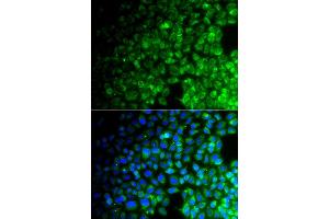 Immunofluorescence analysis of A549 cell using USP10 antibody. (USP10 anticorps)