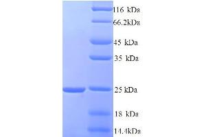 SDS-PAGE (SDS) image for Hematological and Neurological Expressed 1 (HN1) (AA 2-154) protein (His tag) (ABIN5714508)