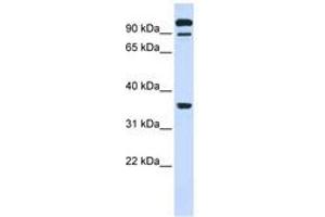 Image no. 1 for anti-Protein tyrosine Phosphatase, Receptor Type, E (PTPRE) (AA 468-517) antibody (ABIN6740985) (PTPRE anticorps  (AA 468-517))