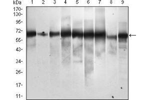 Western blot analysis using SQSTM1 mouse mAb against Hela (1), Jurkat (2), THP-1 (3), HEK293 (4), A549 (5), MCF-7 (6), HepG2 (7), COS7 (8) and SK-BR-3 (9) cell lysate. (SQSTM1 anticorps  (AA 232-356))
