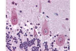 Anti-KIF21A antibody IHC of human brain, cerebellum.