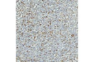 IHC analysis of ALDH1A1 using anti-ALDH1A1 antibody (ABIN7602128). (ALDH1A1 anticorps  (AA 6-342))