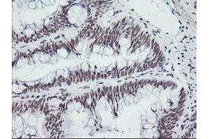 Image no. 1 for anti-SEC14 and Spectrin Domains 1 (SESTD1) antibody (ABIN1501066) (SESTD1 anticorps)