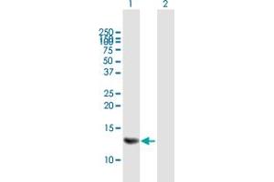Western Blot analysis of MRPS6 expression in transfected 293T cell line by MRPS6 MaxPab polyclonal antibody. (MRPS6 anticorps  (AA 1-125))