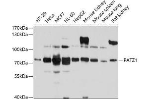 Western blot analysis of extracts of various cell lines, using P antibody (ABIN6132856, ABIN6145252, ABIN6145253 and ABIN6214168) at 1:1000 dilution. (PATZ1 anticorps  (AA 250-350))