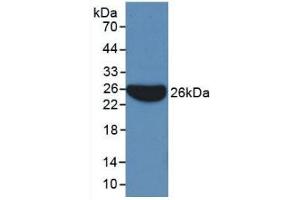 Detection of Recombinant APOB, Human using Monoclonal Antibody to Apolipoprotein B (APOB)