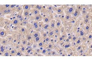 Detection of CD26 in Mouse Liver Tissue using Polyclonal Antibody to Cluster Of Differentiation 26 (CD26)