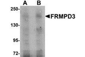 Western blot analysis of FRMPD3 in Jurkat cell lysate with AP30348PU-N FRMPD3 antibody at (A) 1 and (B) 2 μg/ml. (FRMPD3 anticorps  (Center))