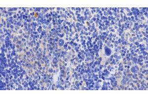 Detection of GPX1 in Mouse Spleen Tissue using Polyclonal Antibody to Glutathione Peroxidase 1 (GPX1)