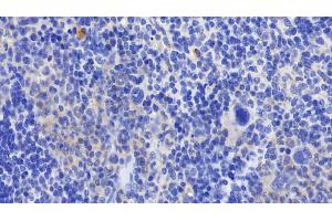 Detection of GPX1 in Mouse Spleen Tissue using Polyclonal Antibody to Glutathione Peroxidase 1 (GPX1) (Glutathione Peroxidase 1 anticorps  (AA 48-201))