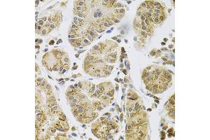 Immunohistochemistry of paraffin-embedded human stomach using PSEN1 Antibody (ABIN5971213) at dilution of 1/100 (40x lens). (Presenilin 1 anticorps)