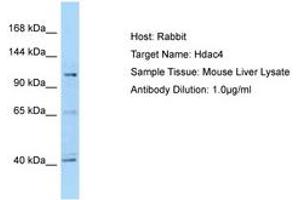 Image no. 1 for anti-Histone Deacetylase 4 (HDAC4) (C-Term) antibody (ABIN6749909) (HDAC4 anticorps  (C-Term))