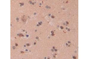 IHC-P analysis of Human Tissue, with DAB staining.