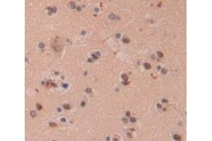 IHC-P analysis of Human Tissue, with DAB staining. (PIN4 anticorps  (AA 23-130))