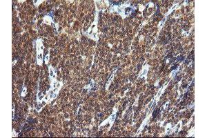 Image no. 2 for anti-Tripartite Motif Containing 44 (TRIM44) antibody (ABIN1501505) (TRIM44 anticorps)