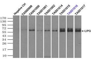 Image no. 6 for anti-Lipase, Endothelial (LIPG) antibody (ABIN1499163) (LIPG anticorps)