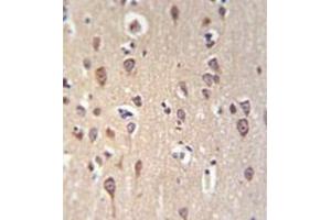 Immunohistochemistry analysis in formalin fixed and paraffin embedded brain tissue reacted with GRPR Antibody (Center) followed by peroxidase conjugation of the secondary antibody and DAB staining.
