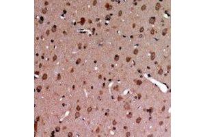 anti-MerTK/Tyro3 (MerTK/Tyro3) (C-Term), (pTyr681), (pTyr749) antibody