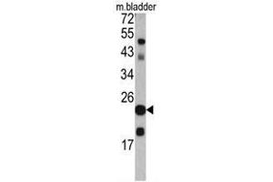 Western blot analysis of TAGLN antibody (C-term) in mouse bladder tissue lysates (35ug/lane). (Transgelin anticorps  (C-Term))