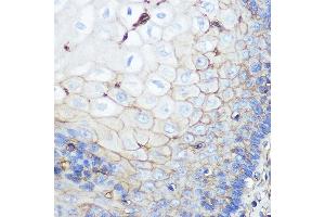Immunohistochemistry of paraffin-embedded human esophageal using beta 2 Microglobulin Rabbit mAb (ABIN7265876) at dilution of 1:100 (40x lens). (beta-2 Microglobulin anticorps)