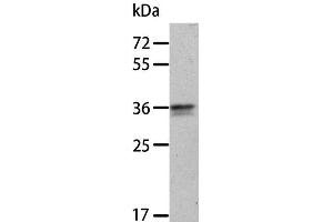 Western Blot analysis of A549 cell using ANXA8 Polyclonal Antibody at dilution of 1:300 (Annexin VIII anticorps)