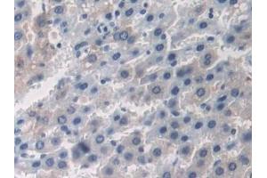 Detection of OAS1 in Rat Liver Tissue using Polyclonal Antibody to 2',5'-Oligoadenylate Synthetase 1 (OAS1) (OAS1 anticorps  (AA 139-358))