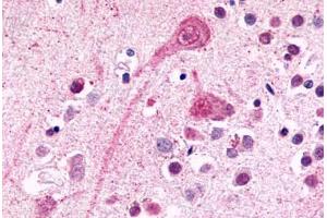 Anti-BDKRB2 / BK-2 antibody  ABIN1048349 IHC staining of human brain, neurons and glia.