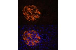 anti-Pancreatic Lipase-Related Protein 2 (PNLIPRP2) (AA 301-470) antibody