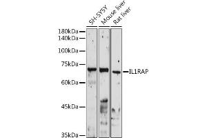 Western blot analysis of extracts of various cell lines, using IL1RAP antibody (ABIN6128127, ABIN6142347, ABIN6142348 and ABIN6220984) at 1:1000 dilution. (IL1RAP anticorps  (AA 21-356))