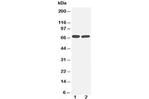 Western blot testing of TNFR2 antibody and Lane 1:  MM453;  2: Jurkat cell lysate. (TNFRSF1B anticorps  (Middle Region))