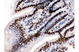 Anti-KAP1 Picoband antibody, IHC(P) IHC(P): Mouse Intestine Tissue