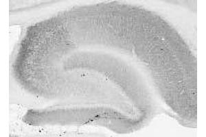 Adult rat brain hippocampus immunohistochemistry. (DLG2 anticorps  (AA 1-852))