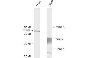 dilution: 1 : 1000, sample: left: rat brain homogenate; right: retina extract (Ribeye (AA 974-988) anticorps)