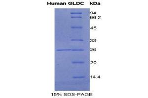 SDS-PAGE (SDS) image for Glycine Dehydrogenase (GLDC) (AA 627-833) protein (His tag) (ABIN1981193)