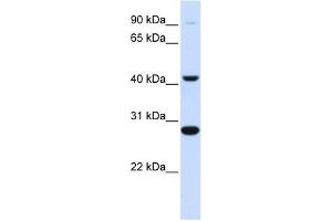 CYB561 antibody used at 1 ug/ml to detect target protein. (CYB561 anticorps  (Middle Region))