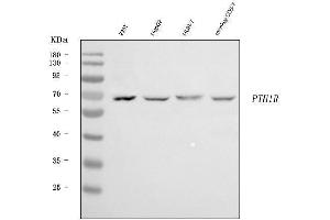 Western blot analysis of Parathyroid Hormone Receptor 1/PTH1R using anti-Parathyroid Hormone Receptor 1/PTH1R antibody (ABIN7599639).