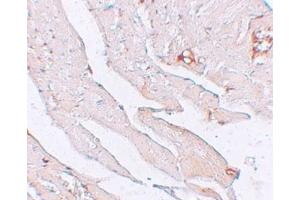 IHC in mouse brain tissue with antibody at 2.