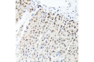 Immunohistochemistry of paraffin-embedded mouse stomach using PARP1 antibody at dilution of 1:100 (x40 lens).