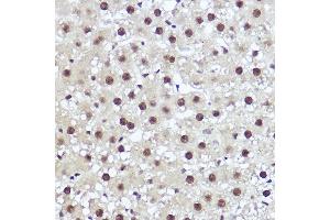 Immunohistochemistry of paraffin-embedded rat liver using WBP11 Rabbit pAb (ABIN7271390) at dilution of 1:100 (40x lens).