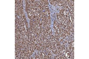 IHC analysis of TRMT61A using anti-TRMT61A antibody (ABIN7599220). (TRMT61A anticorps  (AA 1-289))