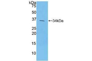 Western blot analysis of recombinant Mouse IRF4. (IRF4 anticorps  (AA 175-433))