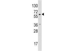 Western blot analysis of CYP19A1 / Aromatase antibody and Jurkat lysate